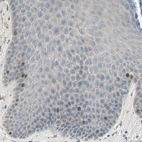 Immunohistochemical staining of human skin shows moderate nuclear positivity in a subset of basal cells in squamous epithelium.