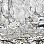 Immunohistochemical staining of human stomach shows moderate nuclear positivity in lymphoid cells.
