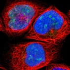 Immunofluorescent staining of human cell line A-431 shows positivity in nucleus & nucleoli.