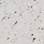 Immunohistochemical staining of human cerebral cortex shows strong cytoplasmic positivity in neurons.