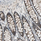 Immunohistochemical staining of human colon shows strong cytoplasmic positivity in glandular cells.