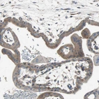Immunohistochemical staining of human placenta shows moderate cytoplasmic positivity in trophoblastic cells.