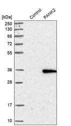 Western blot analysis in control (vector only transfected HEK293T lysate) and PANK2 over-expression lysate (Co-expressed with a C-terminal myc-DDK tag (~3.1 kDa) in mammalian HEK293T cells, LY410958).