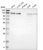 Western blot analysis in human cell line RT-4, human cell line U-251 MG, human plasma, human liver tissue and human tonsil tissue.