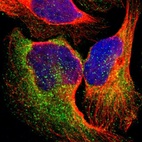 Immunofluorescent staining of human cell line U-2 OS shows localization to cytosol & vesicles.