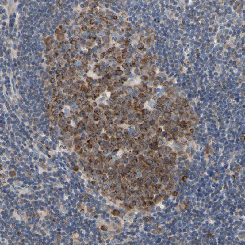 Anti-MCL1 Antibody