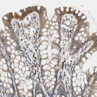 Immunohistochemical staining of human colon shows moderate cytoplasmic positivity in glandular cells.