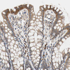 Anti-MCL1 Antibody