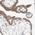 Anti-MCL1 Antibody