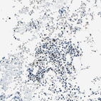 Immunohistochemical staining of human bone marrow shows low positivity in hematopoietic cells as expected.