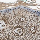 Immunohistochemical staining of human skin shows strong positivity in nuclear membrane in squamous epithelial cells.