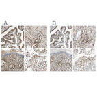 Immunohistochemical staining of human fallopian tube, kidney, skin and testis using Anti-SUN1 antibody HPA008461 (A) shows similar protein distribution across tissues to independent antibody HPA008346 (B).