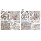 Immunohistochemical staining of human fallopian tube, kidney, skin and testis using Anti-SUN1 antibody HPA008461 (A) shows similar protein distribution across tissues to independent antibody HPA008346 (B).