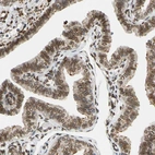 Immunohistochemical staining of human Fallopian tube shows moderate positivity in nuclear membrane in glandular cells.