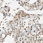 Immunohistochemical staining of human testis shows strong positivity in nuclear membrane in Leydig cells.