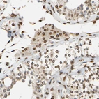 Immunohistochemical staining of human testis shows strong positivity in nuclear membrane in Leydig cells.
