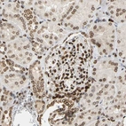 Immunohistochemical staining of human kidney shows strong positivity in nuclear membrane in cells in glomeruli.