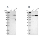 Western blot analysis using Anti-SUN1 antibody HPA008461 (A) shows similar pattern to independent antibody HPA008346 (B).