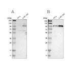 Western blot analysis using Anti-SUN1 antibody HPA008461 (A) shows similar pattern to independent antibody HPA008346 (B).