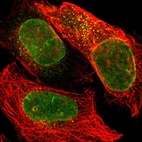 Immunofluorescent staining of human cell line U-2 OS shows localization to nuclear membrane & vesicles.