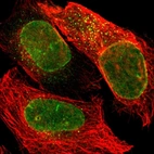 Immunofluorescent staining of human cell line U-2 OS shows localization to nuclear membrane & vesicles.