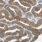 Immunohistochemical staining of human Fallopian tube shows moderate cytoplasmic positivity in glandular cells.