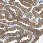 Immunohistochemical staining of human Fallopian tube shows moderate cytoplasmic positivity in glandular cells.