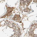 Immunohistochemical staining of human testis shows moderate cytoplasmic positivity in Leydig cells.