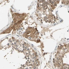 Immunohistochemical staining of human testis shows moderate cytoplasmic positivity in Leydig cells.