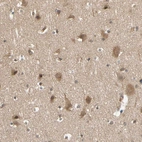 Immunohistochemical staining of human cerebral cortex shows weak cytoplasmic positivity in neurons.