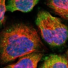 Immunofluorescent staining of human cell line A-431 shows localization to cytosol & vesicles.