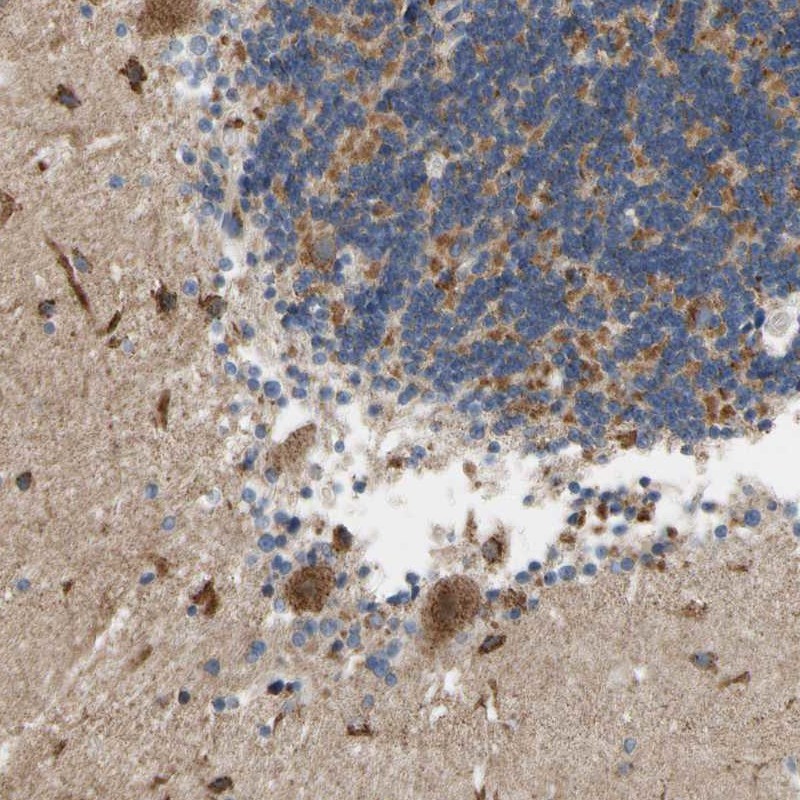 Anti-KLHDC8B Antibody