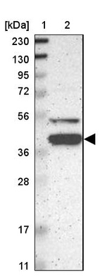 Lane 1: Marker [kDa] 230, 130, 95, 72, 56, 36, 28, 17, 11_br/_Lane 2: Human cell line RT-4