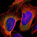 Immunofluorescent staining of human cell line U-2 OS shows localization to cytosol.