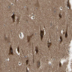Immunohistochemical staining of human Cerebral cortex shows strong cytoplasmic positivity in neurons.
