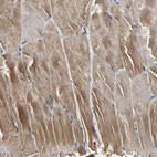 Immunohistochemical staining of human Skeletal muscle shows moderate cytoplasmic positivity in myocytes.