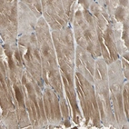 Immunohistochemical staining of human Skeletal muscle shows moderate cytoplasmic positivity in myocytes.