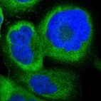 Immunofluorescent staining of human cell line A-431 shows localization to cytosol.