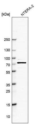 Western blot analysis in human cell line NTERA-2.