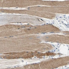 Anti-CA14 Antibody