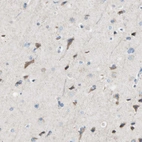 Immunohistochemical staining of human cerebral cortex shows moderate cytoplasmic positivity in neuronal cells.