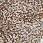 Immunohistochemical staining of human liver shows strong membranous positivity in hepatocytes.