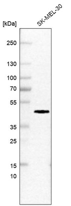 Western blot analysis in human cell line SK-MEL-30.