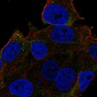 Immunofluorescent staining of human cell line SK-MEL-30 shows localization to plasma membrane.