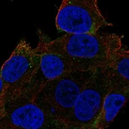 Immunofluorescent staining of human cell line SK-MEL-30 shows localization to plasma membrane.