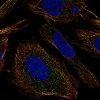 Anti-TMEM9 Antibody