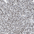 Immunohistochemical staining of human parathyroid gland shows strong nuclear positivity in glandular cells.