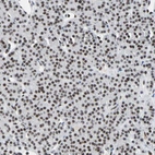 Immunohistochemical staining of human parathyroid gland shows strong nuclear positivity in glandular cells.