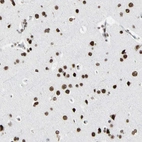 Immunohistochemical staining of human cerebral cortex shows strong nuclear positivity in neuronal cells.