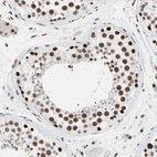 Immunohistochemical staining of human testis shows strong nuclear positivity in cells in seminiferous ducts.